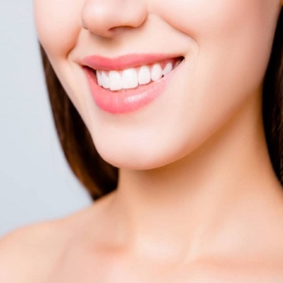 The Ultimate Guide to Teeth Whitening in Dubai: What You Need to Know