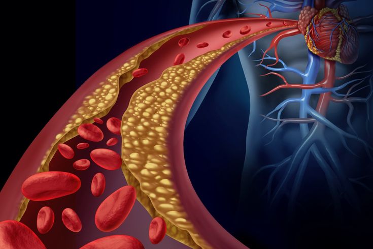 Arterial Catheters Market Size Future Developments To 2033
