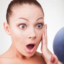 A Teen’s Guide to Acne Treatment in Dubai Best Tips and Clinics