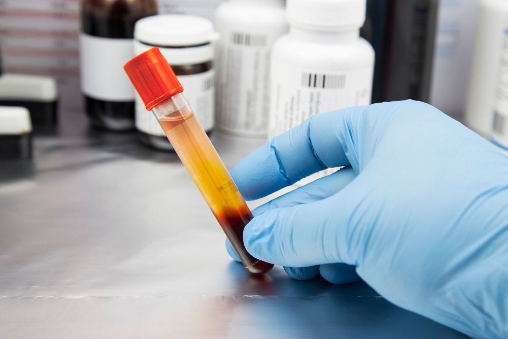 Top Companies in the Plasma Fractionation Market