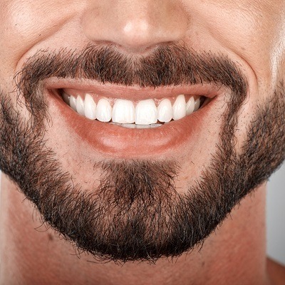Teeth Whitening and Dental Hygiene: The Perfect Pair