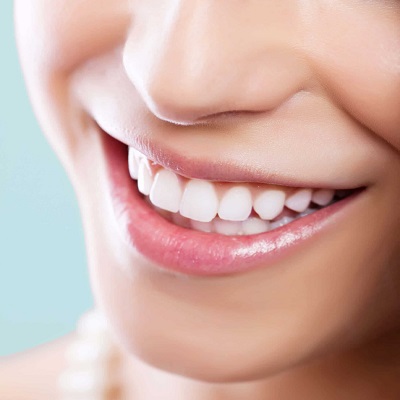Top 10 Questions to Ask Before Choosing a Teeth Whitening Service in Dubai