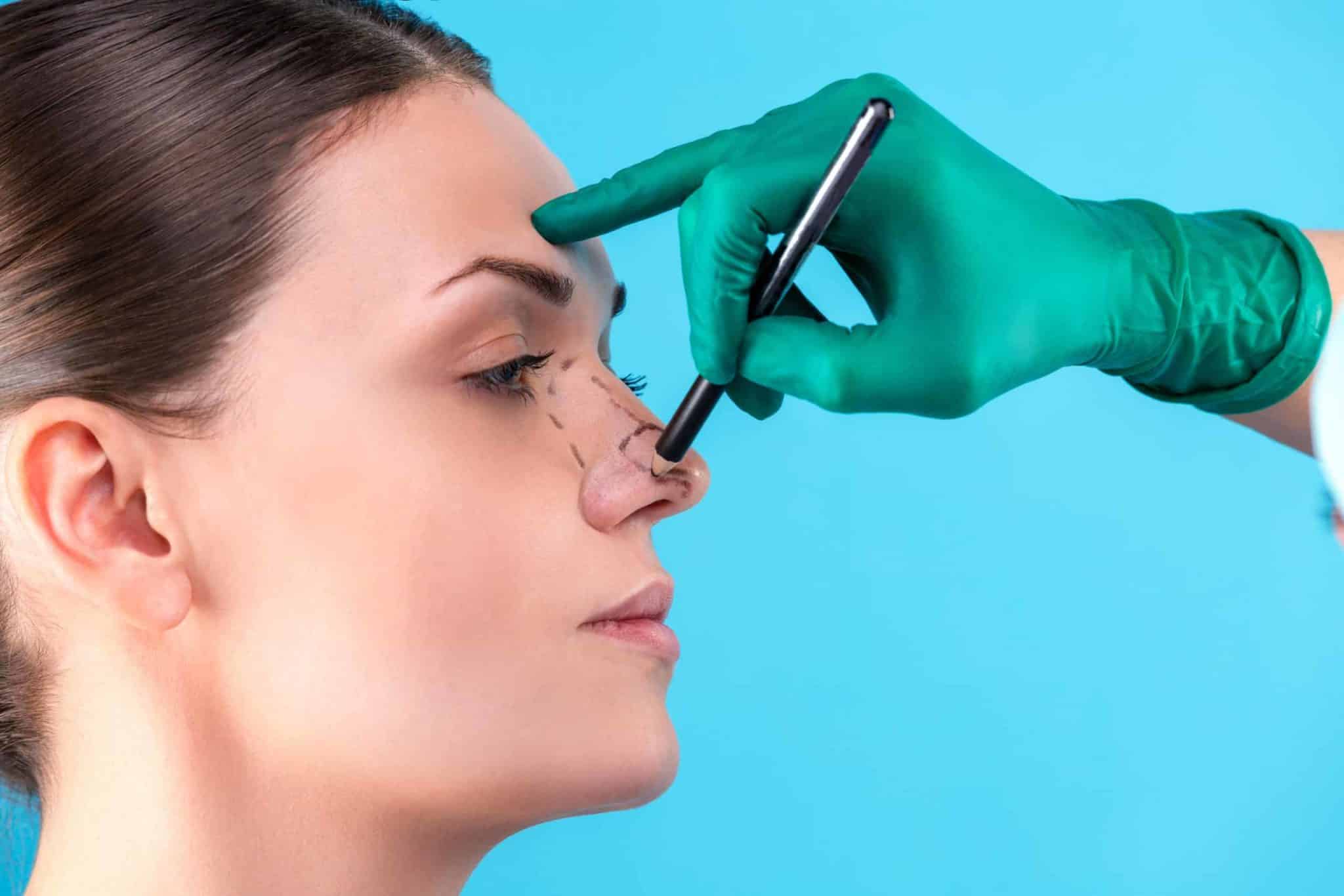 Find the Best Nose Job Surgeons in Riyadh