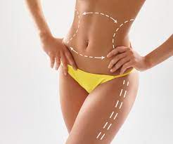What Makes Riyadh the Hub for the Best Liposuction Surgery?