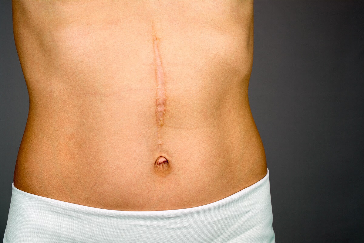 Rejuvenate Your Skin with Scar Reduction Treatments