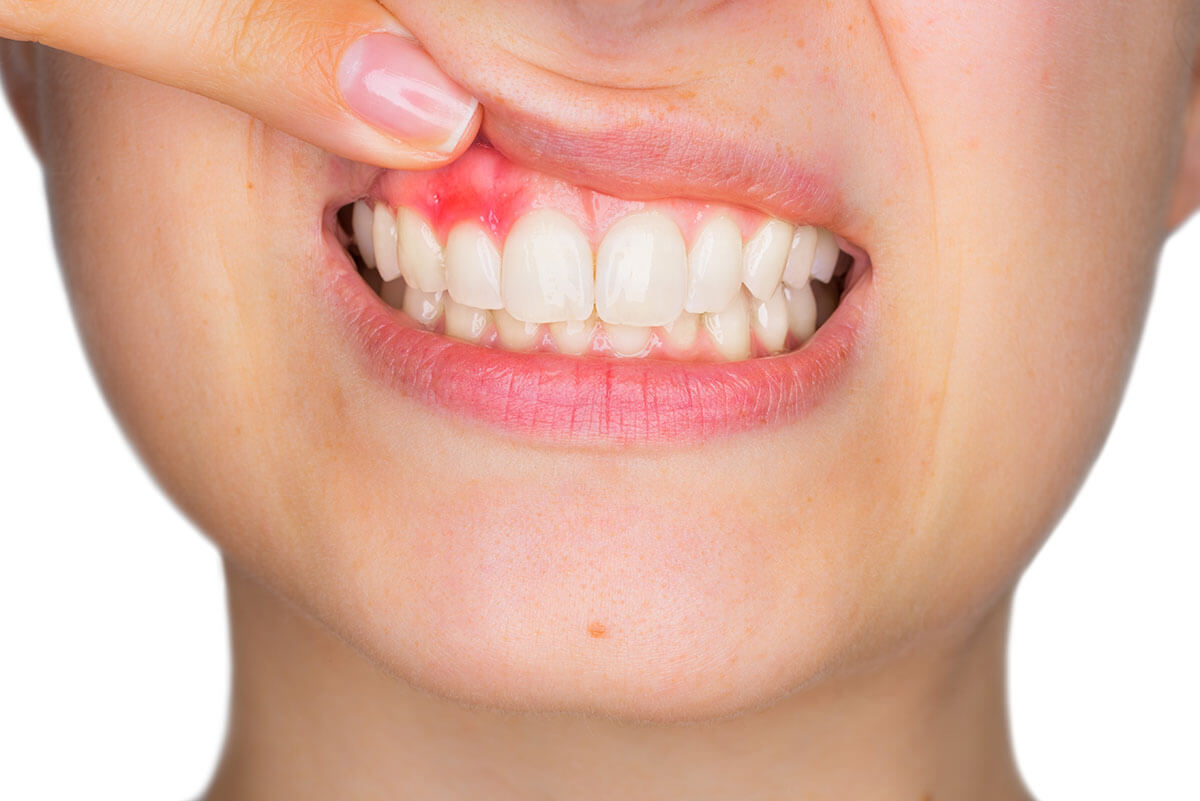 Tailored Gum Contouring Treatments for Every Smile