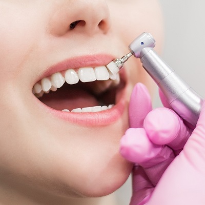 The Science Behind Effective Dental Stain Removal in Dubai