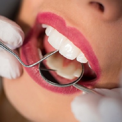 The Role of pH Levels in Preventing and Treating Dental Stains