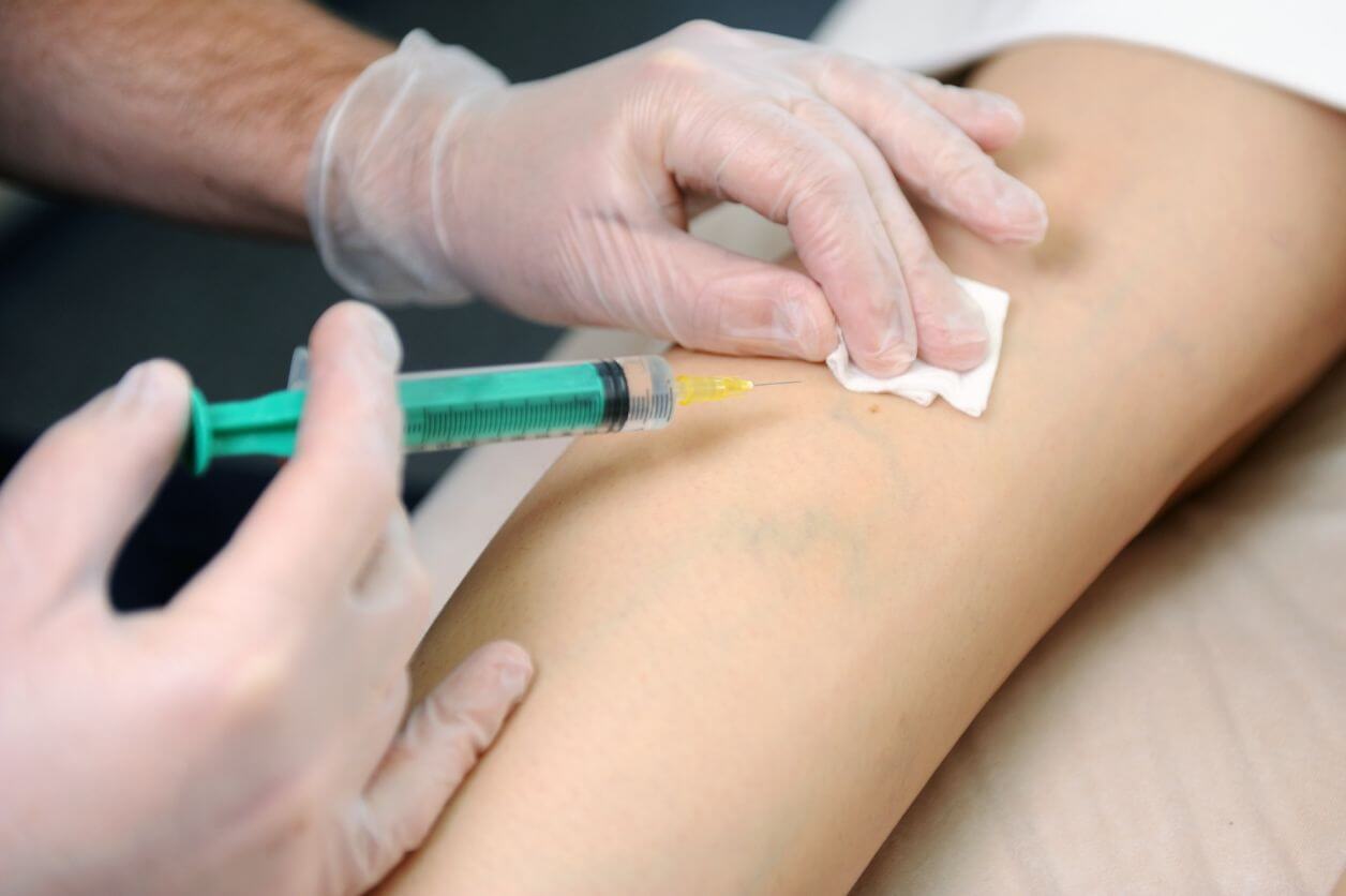 Treating Blocked Arteries and Veins with Vascular Surgery