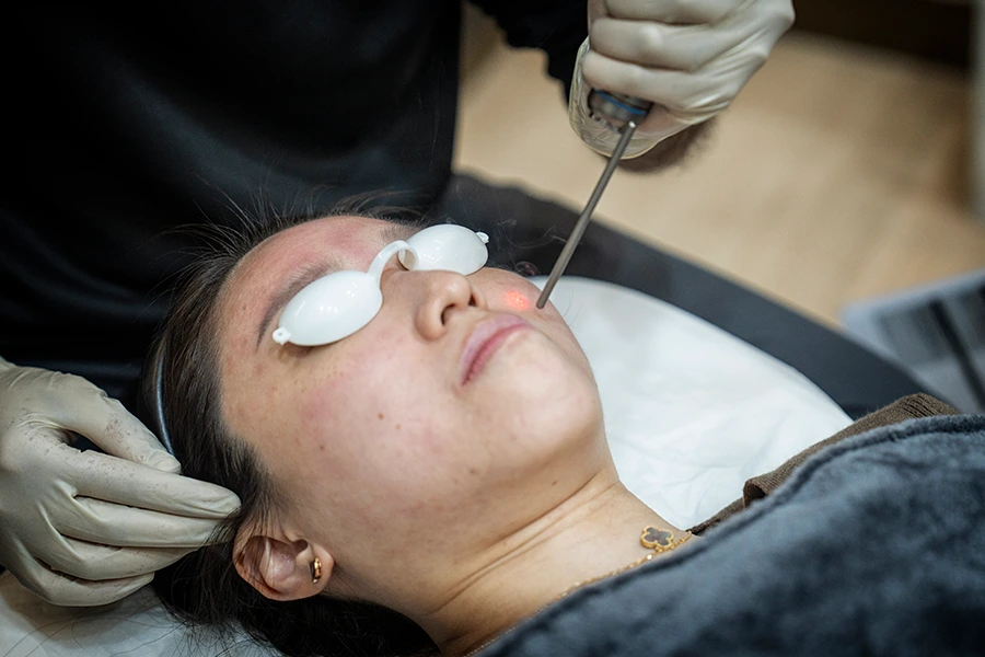 Pico Laser Treatment in Dubai: A Comprehensive Guide