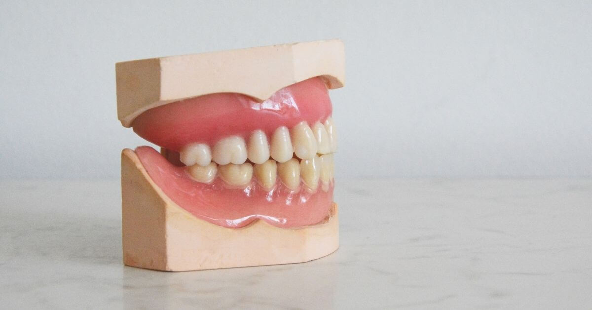 Why More People Are Choosing Dentures for a Perfect Smile