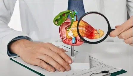 استكشاف أحدث تقنيات إزالة حصوات المرارة