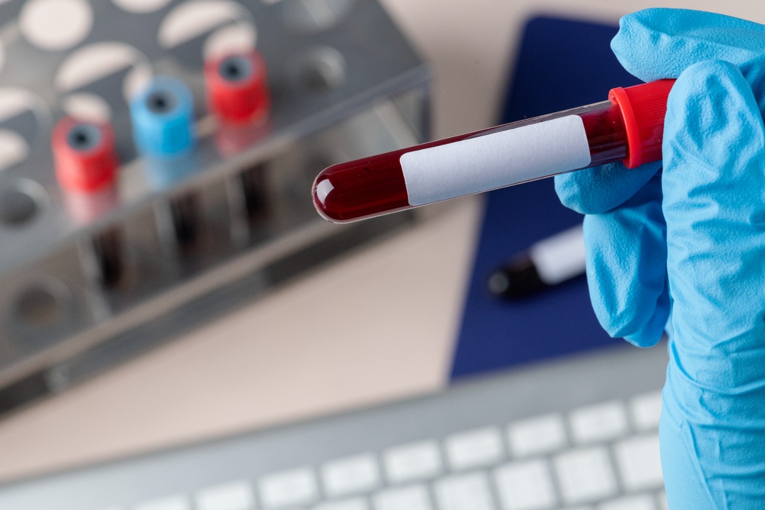 Home Blood Tests: The Ultimate Convenience for Busy Lifestyles