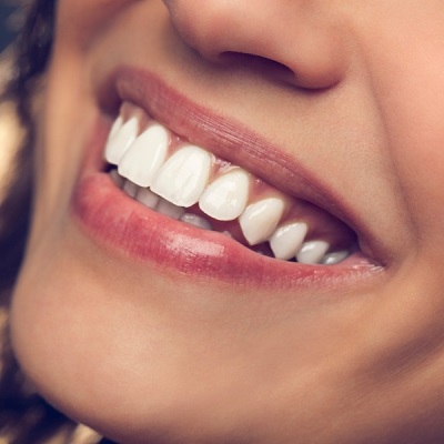 How Digital Smile Design Can Improve Bite Issues in Dubai