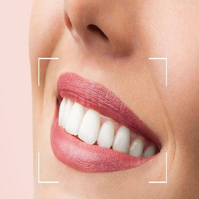 The Pros and Cons of Digital Smile Design for Your Dental Treatment