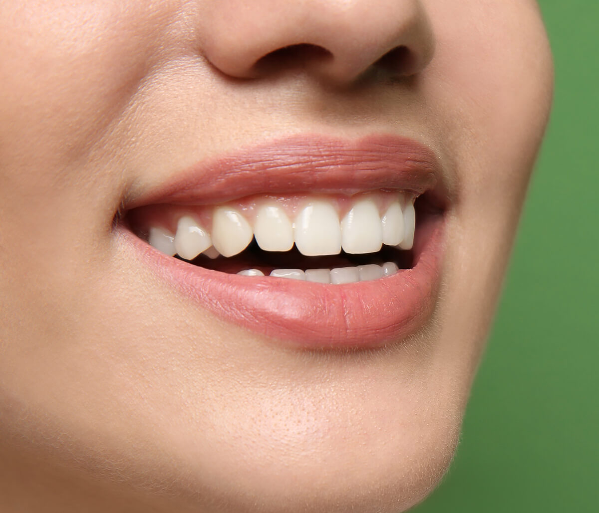 Teeth Whitening Treatments You Can Trust in Dubai