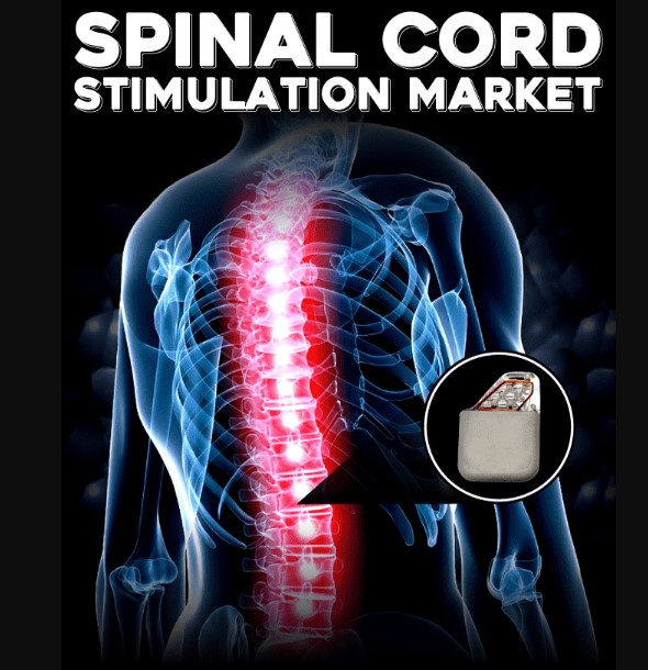 Spinal Cord Stimulation Market: Key Trends and Future Opportunities