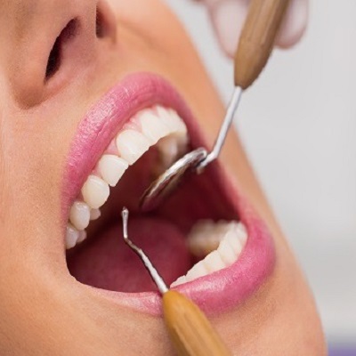 The Connection Between Oral Health and Heart Disease