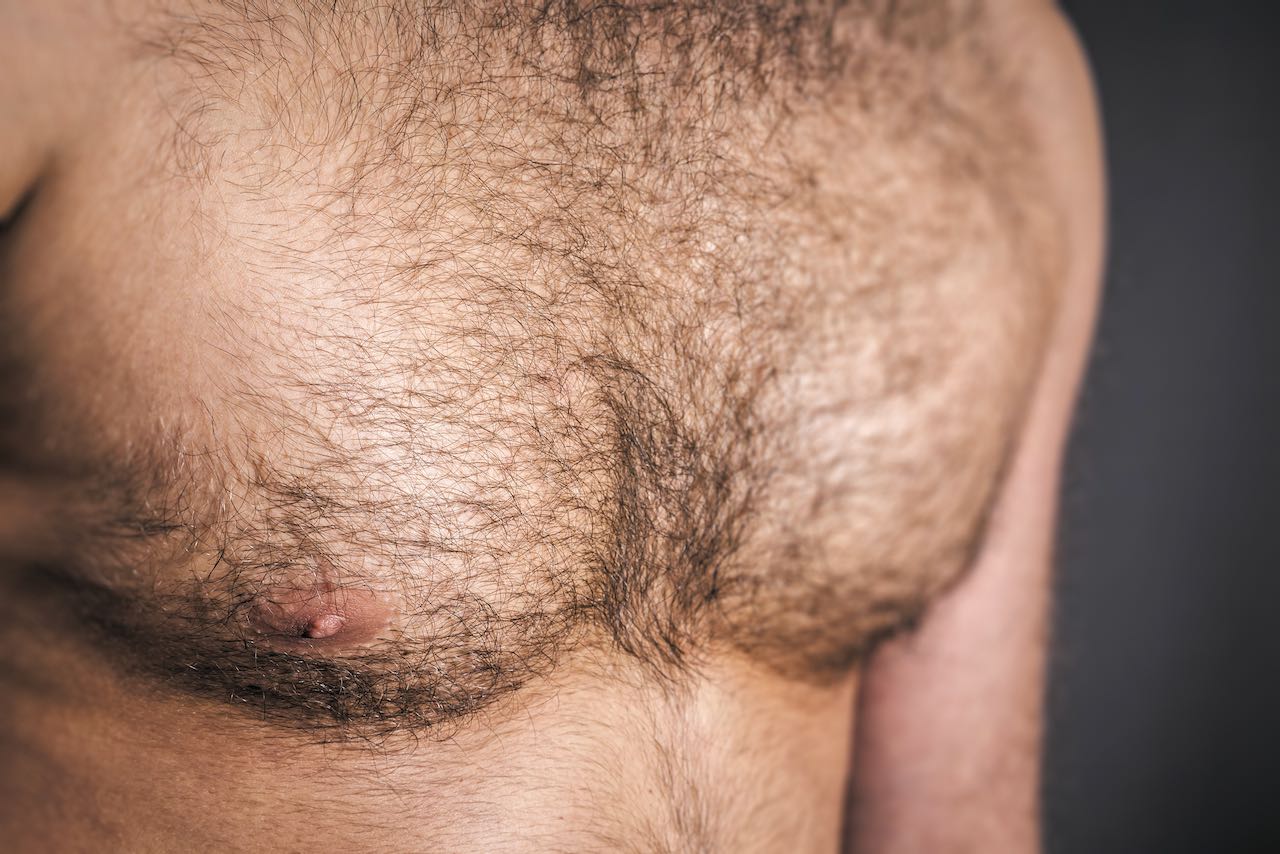 لماذا تعتبر عيادات دبي الحديثة رائدة في مجال زراعة الشعر بالجسم
