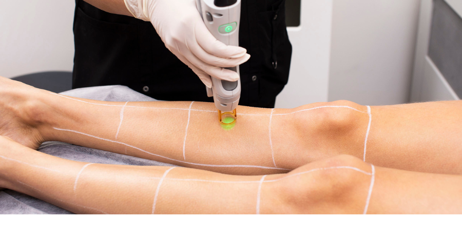 How to Maintain Smooth Skin After Laser Hair Removal