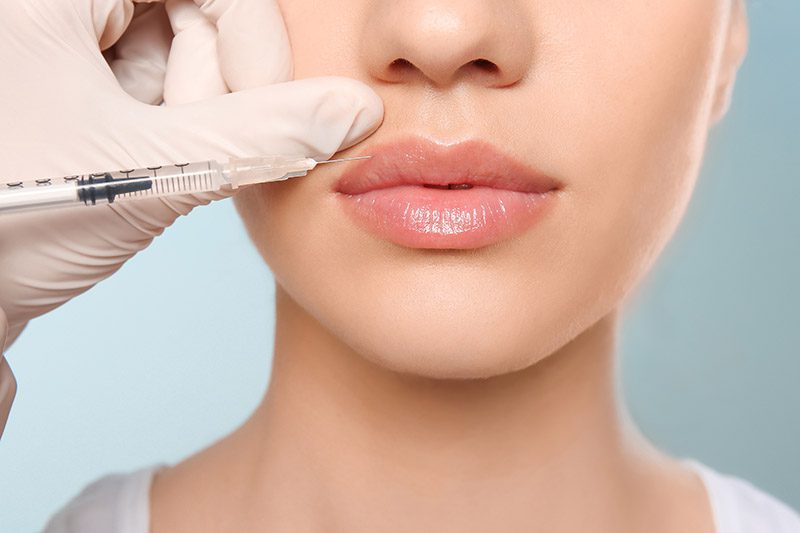 Lip Fillers in West Palm Beach: Everything You Need to Know