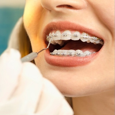 Choosing the Right Orthodontist in Dubai: Questions You Should Ask