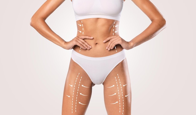 What is the recovery time of liposuction?