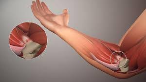 Soft Tissue Repair Market Growth, Size, Share, Outlook, Report 2024-2032