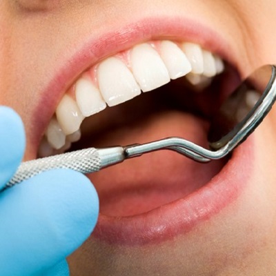 The Rise of Clear Aligners: Are They Right for You?