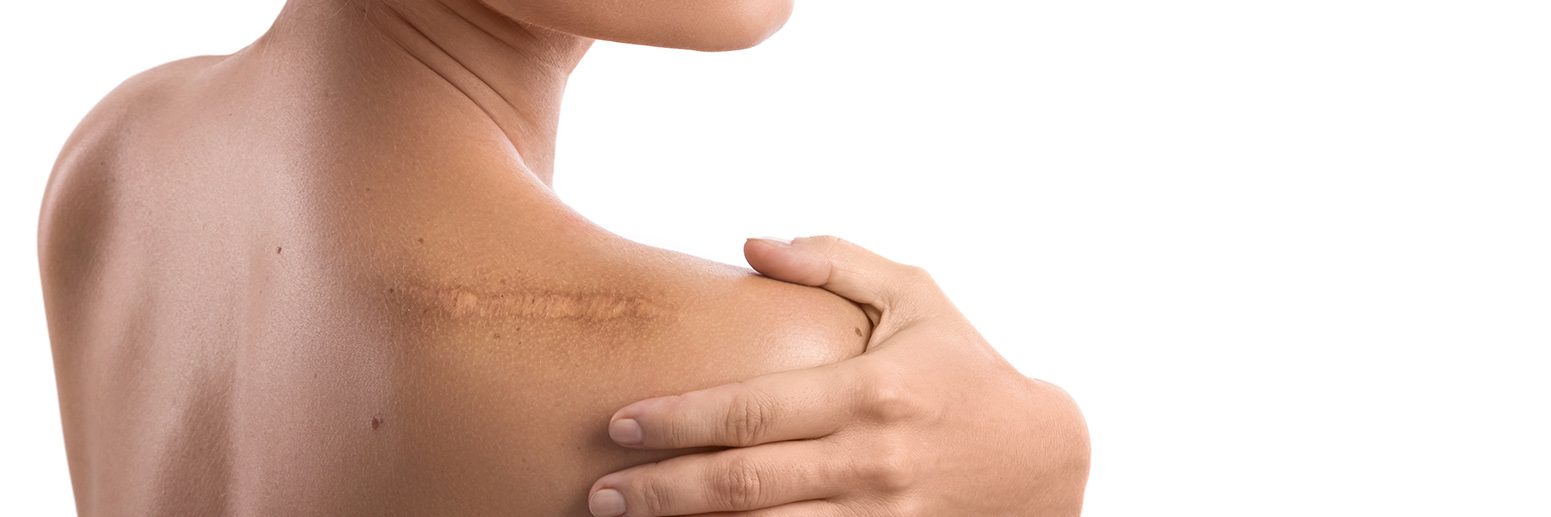 Scar-Free Recovery Post-Surgical Treatments You Can Trust