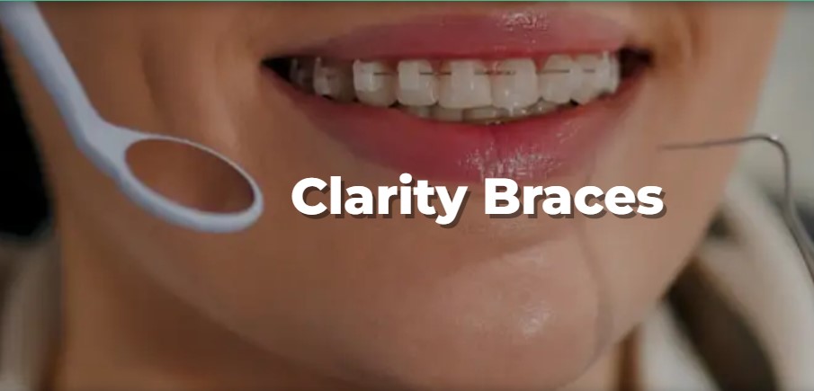 Dentures: An Overview of the Types and Benefits
