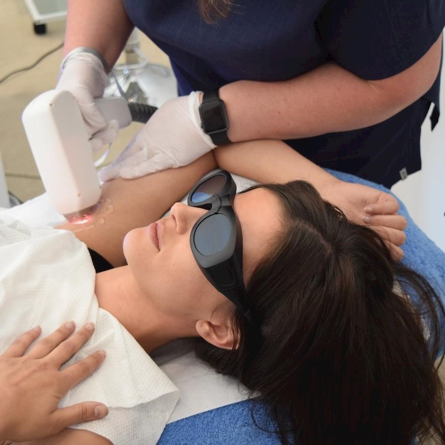 Is Laser Hair Removal Considered Haram in Islam?