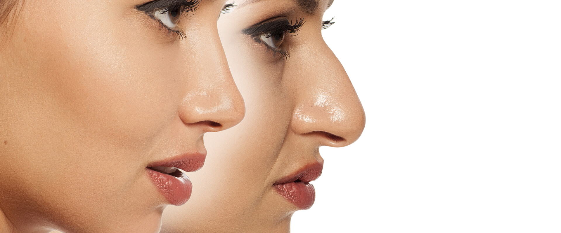 The Benefits of Getting Rhinoplasty in Dubai