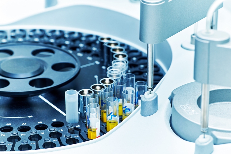 Laboratory Automation Market Share, Growth, Analysis, Size, Trends, Forecast 2025-2033