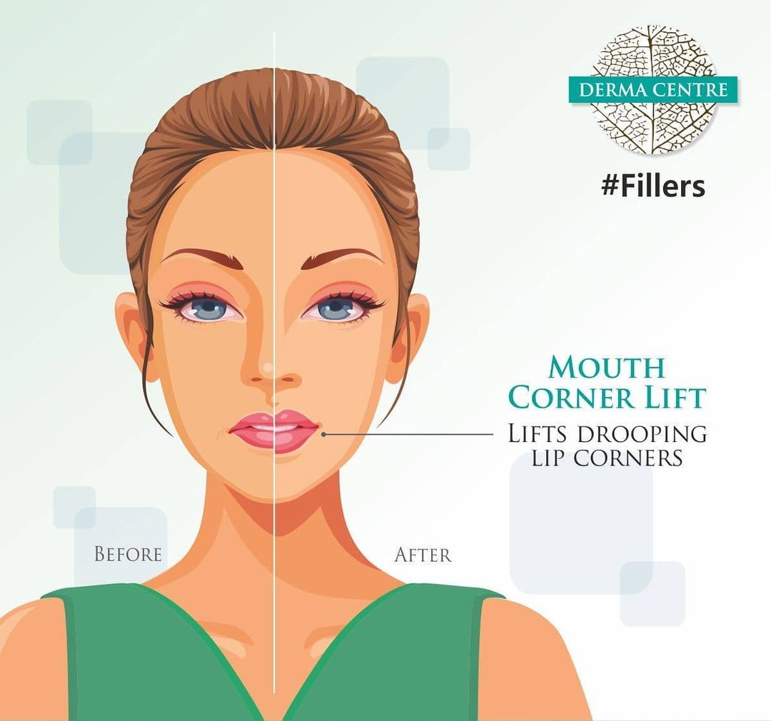Dermatologist Specialist vs. General Dermatologist: What’s the Difference?