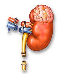 Frequently Asked Questions About Simple Nephrectomy in Dubai