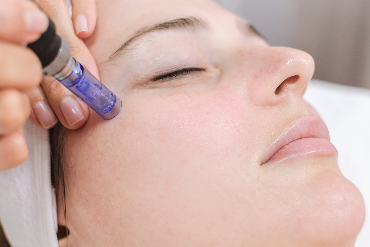 Top Microneedling Clinics in Islamabad: Where to Go for Beautiful Skin
