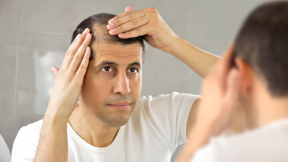 Is Finasteride for Hair Loss Suitable for Women?