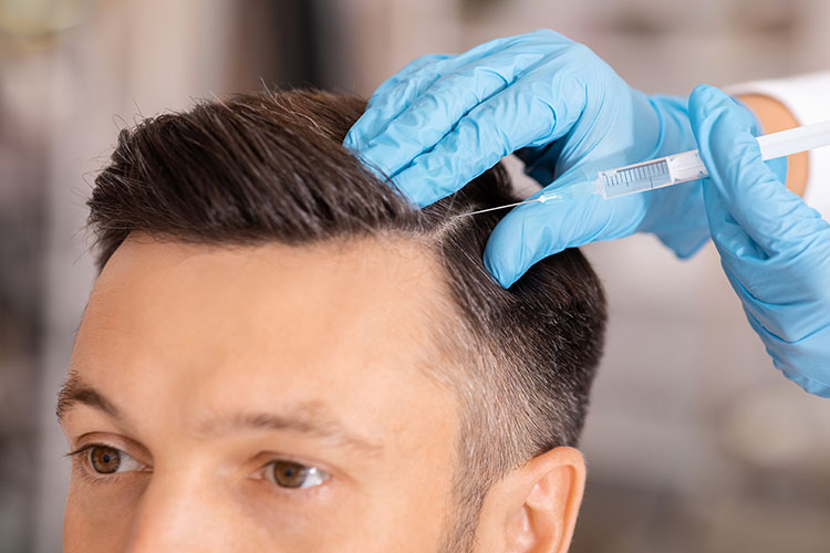 PRP Hair Treatment for Scalp Rejuvenation: A Breakthrough in Hair Care