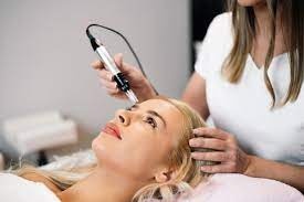 Top Benefits of Microneedling Treatment in Islamabad