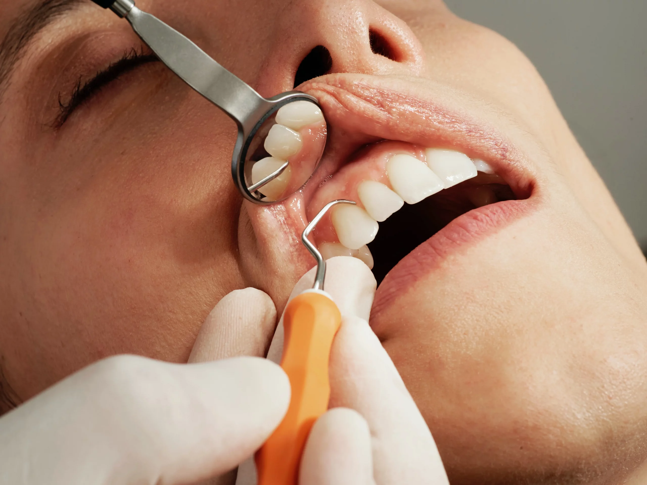 How Root Canal Treatment Can Help Prevent Future Dental Problems