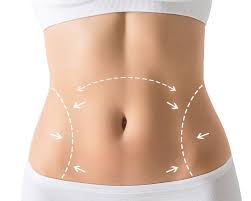 Can Liposuction in Dubai Remove Stubborn Fat from Multiple Areas?