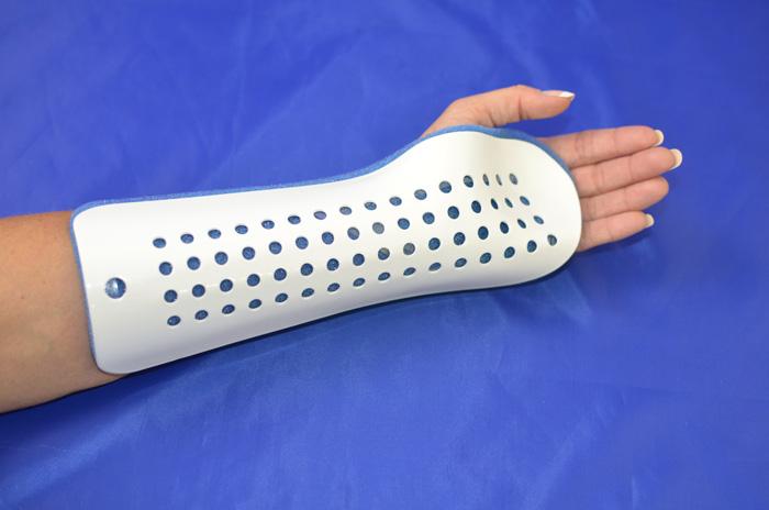 Orthopedic Splints Market Size, Trends, Growth Factors, and Forecast 2025-2033