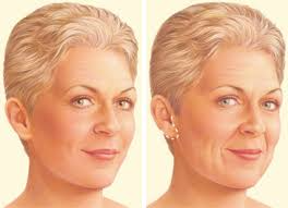 Best 7 Neck Lift Providers in San Diego