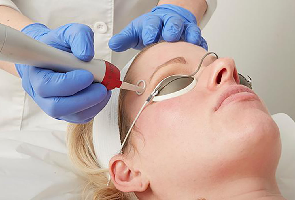 Pico Laser for Scarring: Can It Help With Surgical Scars?
