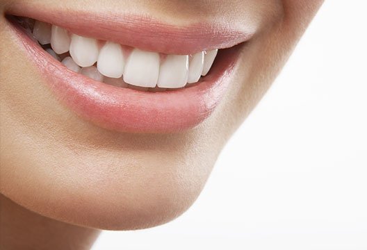 Composite Veneers for Crooked Teeth: A Non-Invasive Alternative