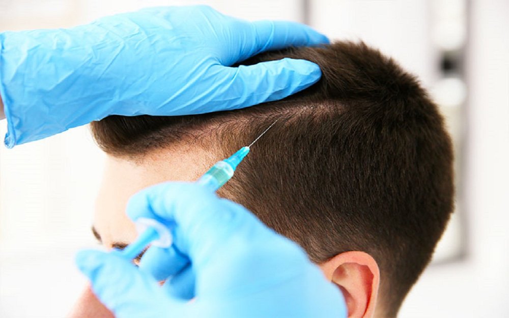 How Do PRP Hair Treatments Help With Hair Regrowth?