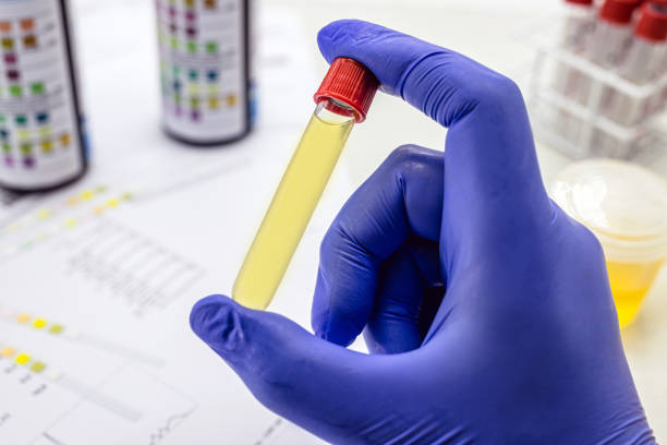 Early Toxicity Testing: Essential Essence of Drug Development