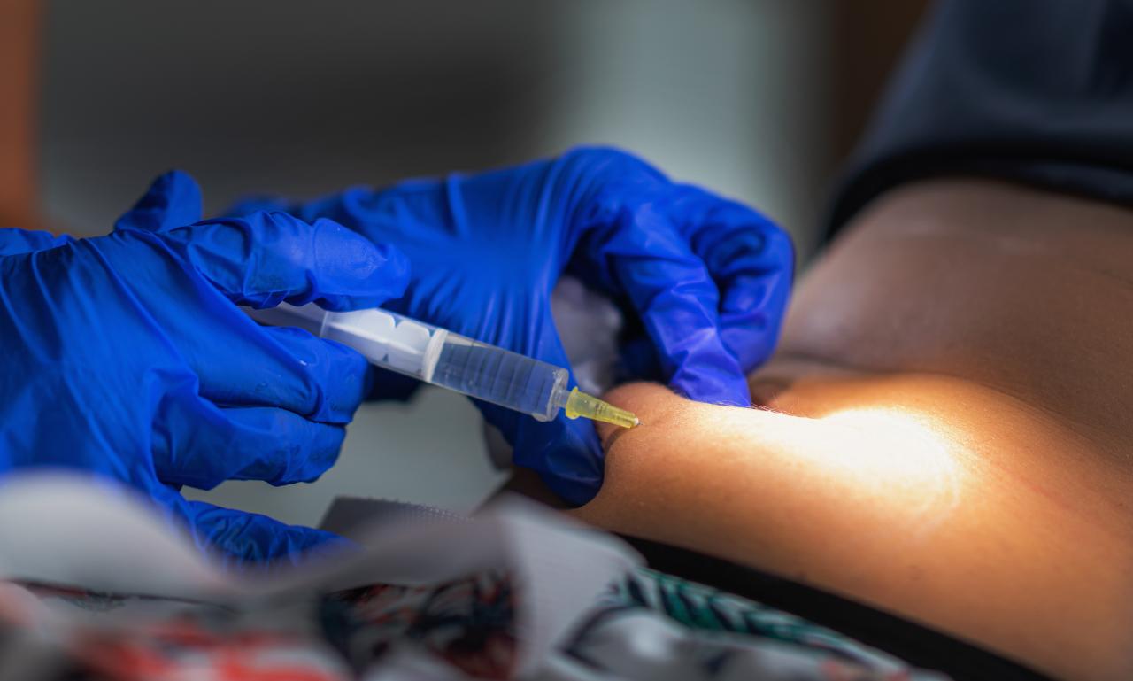 Best 3 Liposuction Providers in Tucson