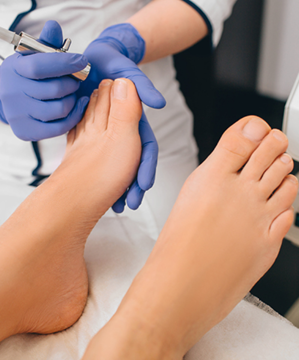 Potential Side Effects of Skin Wart Removal Treatments in Dubai and Their Impact on Cost